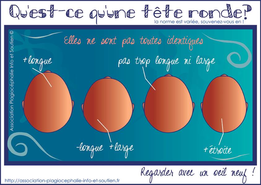 tetes-rondes